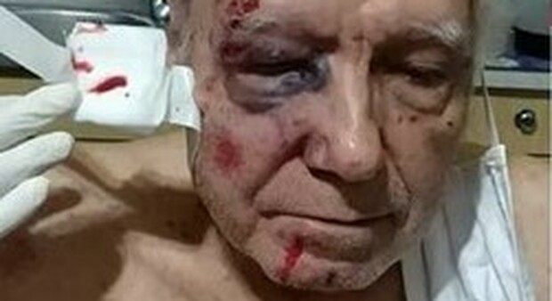 Falegname di 83 anni aggredito in strada: calci e pugni in faccia, è giallo a Nocera