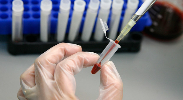 Epatite e Hiv, test gratuiti in tutta Europa dal 18 al 25 novembre