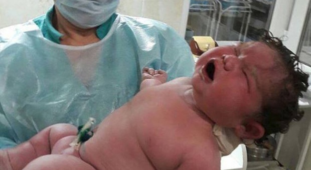 Russia, nasce una bambina gigante: pesa 6,3 kg