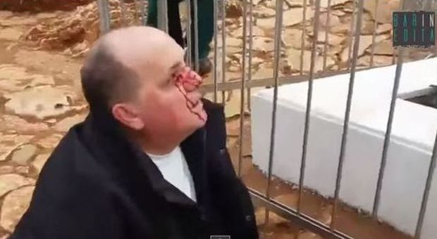 «Incredibile a Medjugorie, uomo prega la Madonna e piange lacrime di sangue» | Video