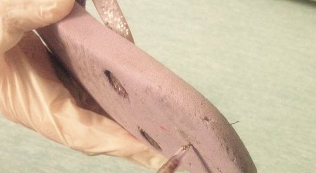 Salerno, bimba di otto anni punta da una siringa abbandonata in spiaggia
