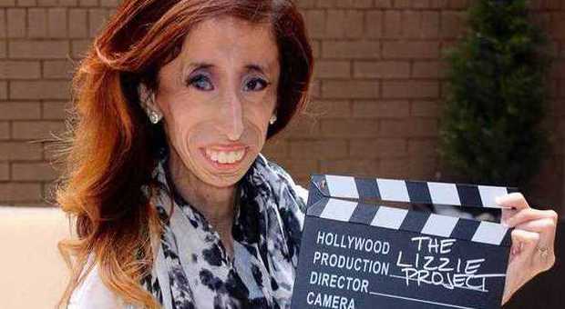 la persona più magra del mondo