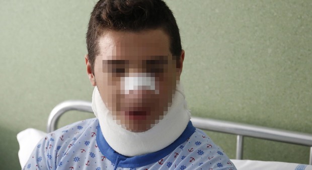Vincenzo, 12 anni, picchiato dai bulli : "Non ho ceduto"