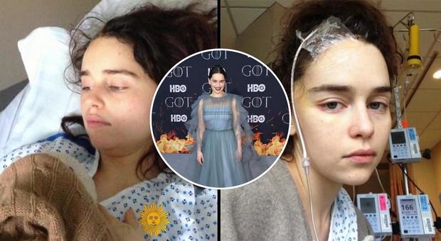 Emilia Clarke, le foto choc della star di Game of Thrones dopo i due aneurismi