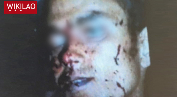 «Il terrorista di Nizza è stato ucciso» la foto diffusa da fonti investigative