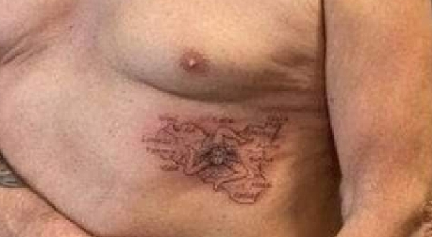 Coronavirus, bergamasco guarito a Palermo si tatua la Sicilia sul corpo: «Promessa mantenuta»