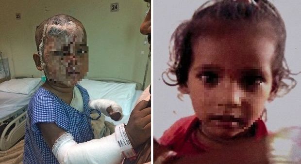 Bimbo di due anni rapito, sfigurato con l'acido e abbandonato: vendetta contro la madre