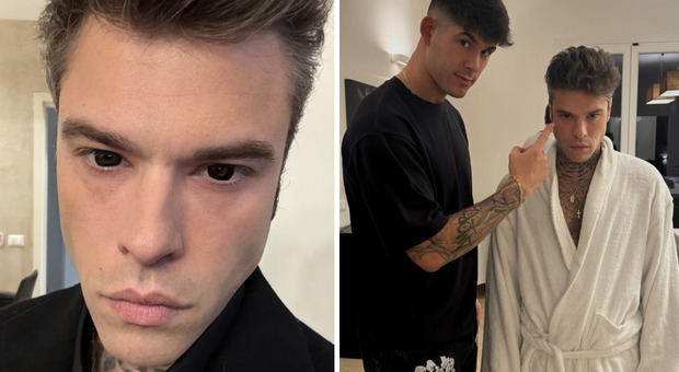 https://statics.cedscdn.it/photos/MED/92/06/8679206_25092842_fedez.jpg