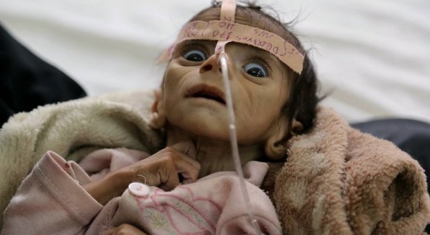 La storia dietro la foto del bambino di 5 mesi che ha sconvolto il mondo: "Non ha pianto"