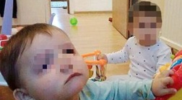 Gb, padre uccide il figlio di 18 mesi a martellate e ferisce gravemente la gemellina: «Non sono figli miei, sono bianchi»
