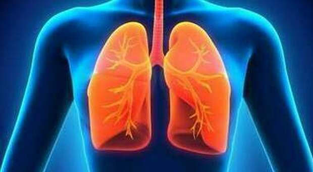 Tumore al polmone, trovate le cause nei non fumatori: passo chiave per terapie personalizzate