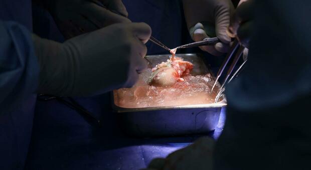 Trapianto di rene di maiale su un paziente in vita, a Boston il primo caso al mondo (e i risultati fanno ben sperare)