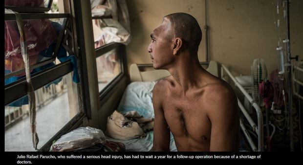 Julio Rafael Parucho, che ha subito un grave trauma cranico, ha dovuto aspettare un anno per l'operazione (foto di Meridith Kohut per il New York Times)