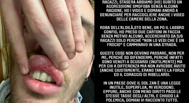 Simone Baroni vittima di aggressione omofoba a San Giovanni. La denuncia sui social depositata ai Carabinieri
