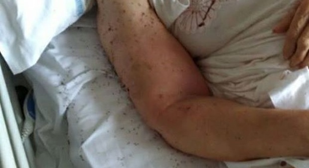 Napoli choc: paziente a letto in ospedale tra le formiche