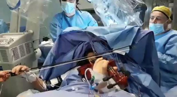 L'intervento al cervello mentre la paziente suona il violino