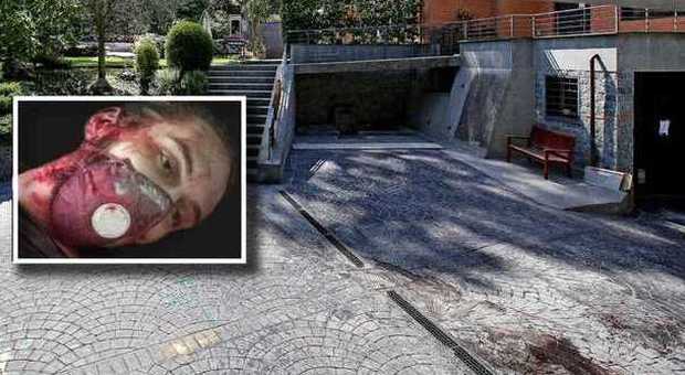 Leonelli ucciso da un colpo al torace Medico legale: «Impressionato dallo strazio del corpo di Oksana»