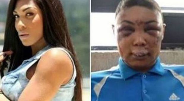 Brasile, modella transgender picchiata e sfigurata in carcere: la polizia nega