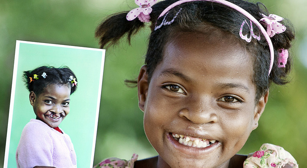 Vino all'asta per comprare medicine ai bambini: i fondi di «For Smiles» arrivano in Guatemala, India e Madagascar