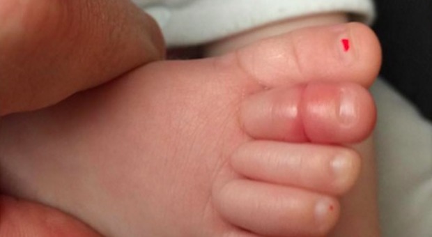 Pubblica la foto del piede della sua bimba: «Genitori, fate attenzione alle dita