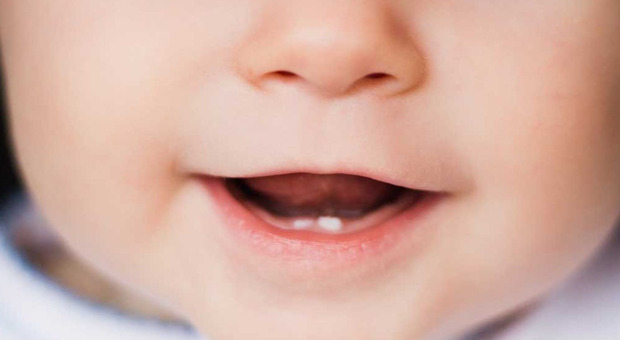 Bimbo nato con un dente, raro caso di dentizione precoce a Perugia: cosa significa e quali rischi comporta