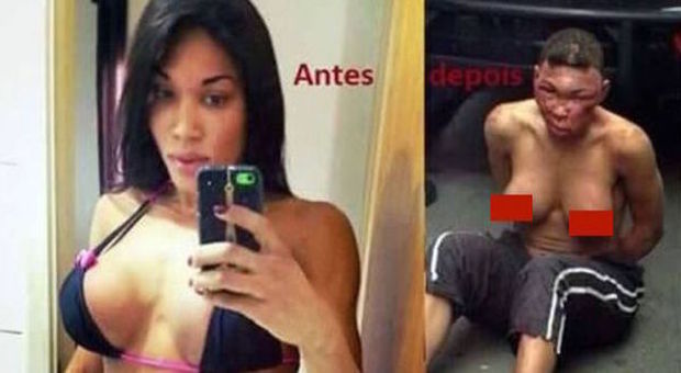 Brasile, modella transgender picchiata e sfigurata in carcere: la polizia nega
