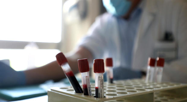 Test sierologici nei laboratori, 2 positivi su 100: «Bisognare farne di più»