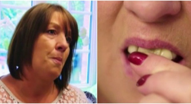 Usa la colla per riattaccarsi i denti caduti(Pinterest/BBC)