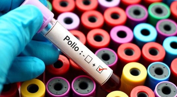 Polio, torna il virus in Gran Bretagna dopo venti anni: trovato nelle acque di scarico di Londra