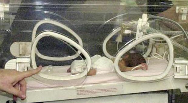 Treviso, dramma durante il parto: muoiono due gemelli: 4 anni fa era morta anche la sorellina
