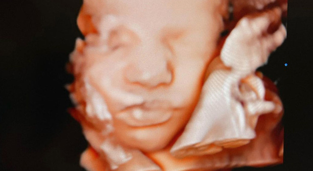 Chiara Ferragni, la nuova ecografia della bimba in arrivo. I fan notano un dettaglio: «Guarda le labbra...»