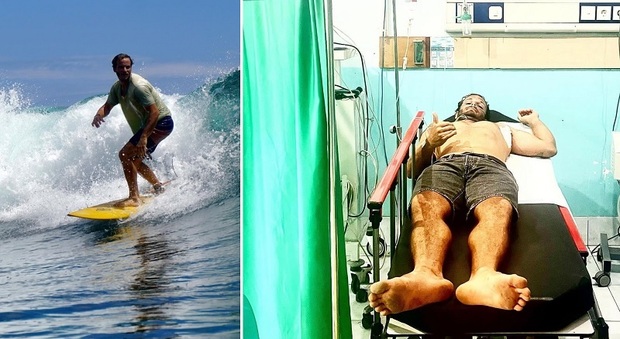 Alberto Marcon, trafitto al petto dal pesce spada mentre fa surf