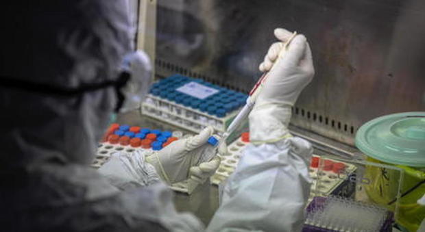 Coronavirus, corsa al vaccino: a Oxford test su 6000 volontari entro maggio