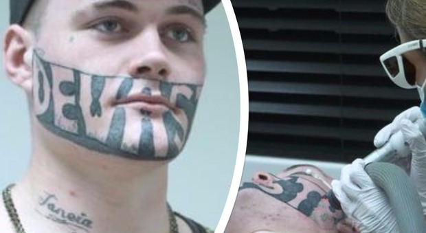 Non trova lavoro per via del vistoso tatuaggio sul volto, ecco cosa decide di fare