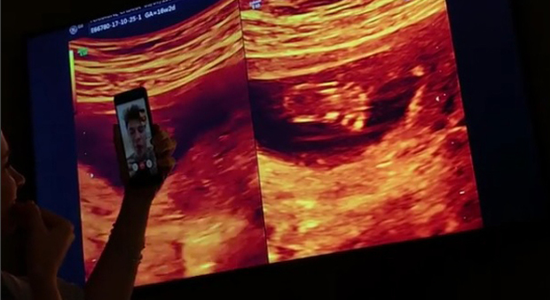 Chiara Ferragni incinta, ecografia in diretta via Facetime con Fedez