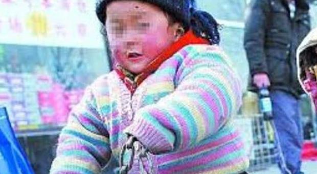 Cina, malattia misteriosa fa cadere le unghie a 17 bambini di un asilo