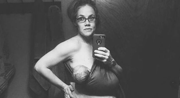 Erica e il selfie post partum: "Così è cambiato il mio corpo"