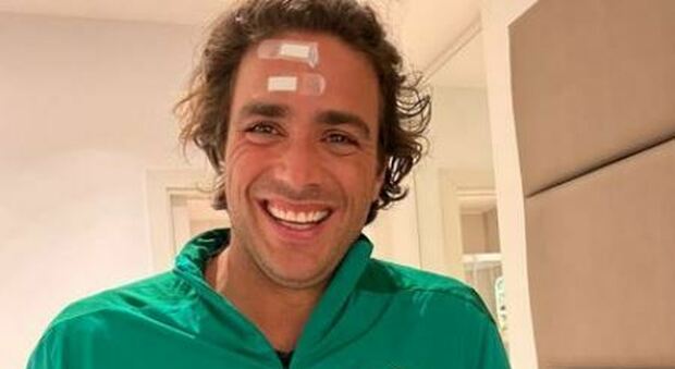Alessandro Matri resta ferito in un incidente domestico con le bambine