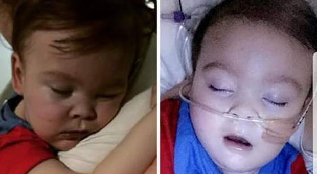 «Alfie respira da solo»: i genitori pubblicano foto su Instagram dopo il distacco dei macchinari
