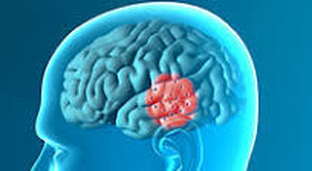 Parkinson, nell'area della serotonina i primi indizi della malattia