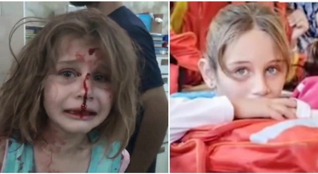 La piccola Aya ferita invoca il papà: simbolo degli orrori in Siria