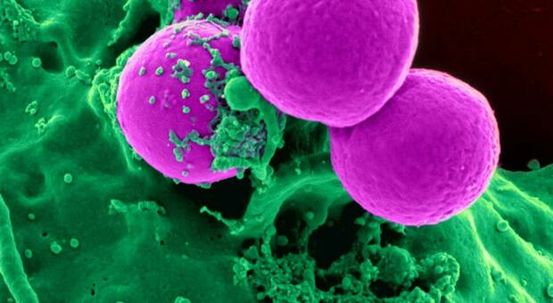 Tumori, diagnosi in anticipo grazie a delle proteine spia: possono rivelare il cancro con almeno sette anni di preavviso