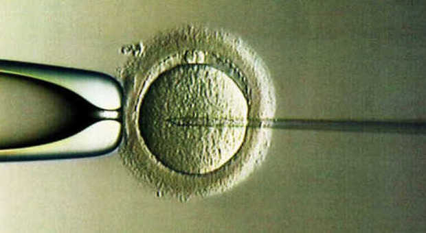 Spermatozoi umani ottenuti in vitro: ​è la prima volta al mondo
