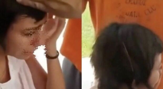 Padre rasa la testa alla figlia per punizione: la ragazza aveva preso in giro il compagno di classe malato di cancro