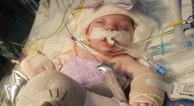 Bimba di 3 mesi in coma dopo le percosse: la mamma e il papà l'hanno picchiata e abbandonata a se stessa