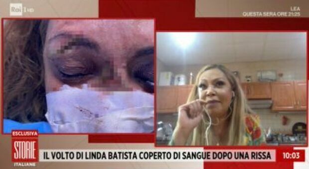 Linda Batista a Storie Italiane: «Colpita in faccia col tacco di una scarpa». Il suo volto coperto di sangue