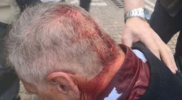 Folla in strada nel Napoletano, vigile interviene e finisce in ospedale con una ferita alla testa