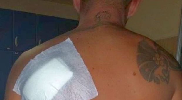 Napoli, ferito in un agguato minaccia i nemici su Facebook: "Avita muriii"