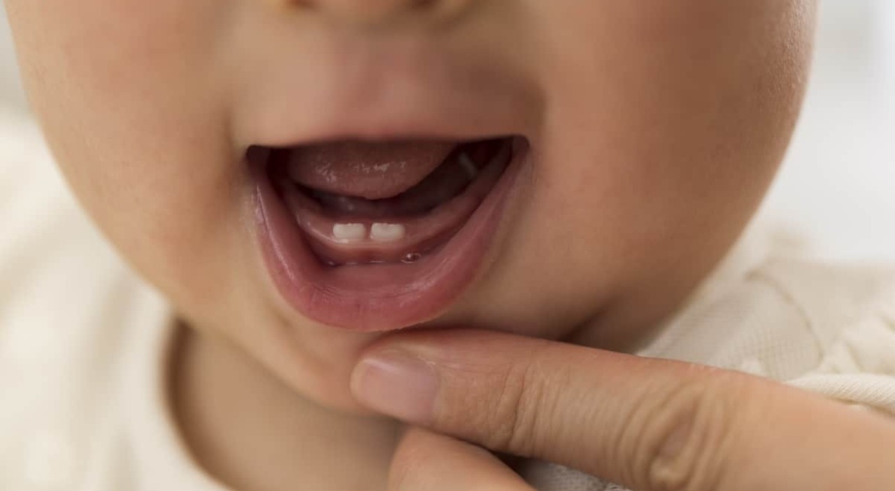 Take care of oral hygiene even on milk teeth, how to prevent cavities and health problems