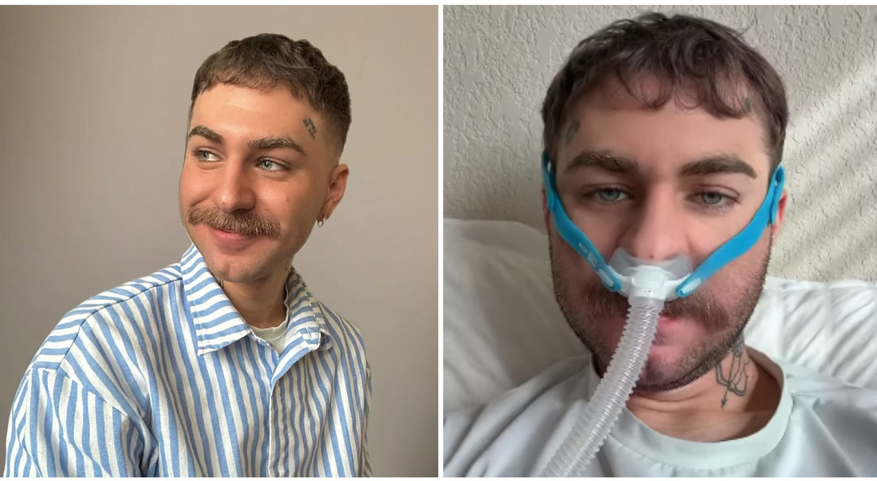 At 25, I Discovered I Had SLA